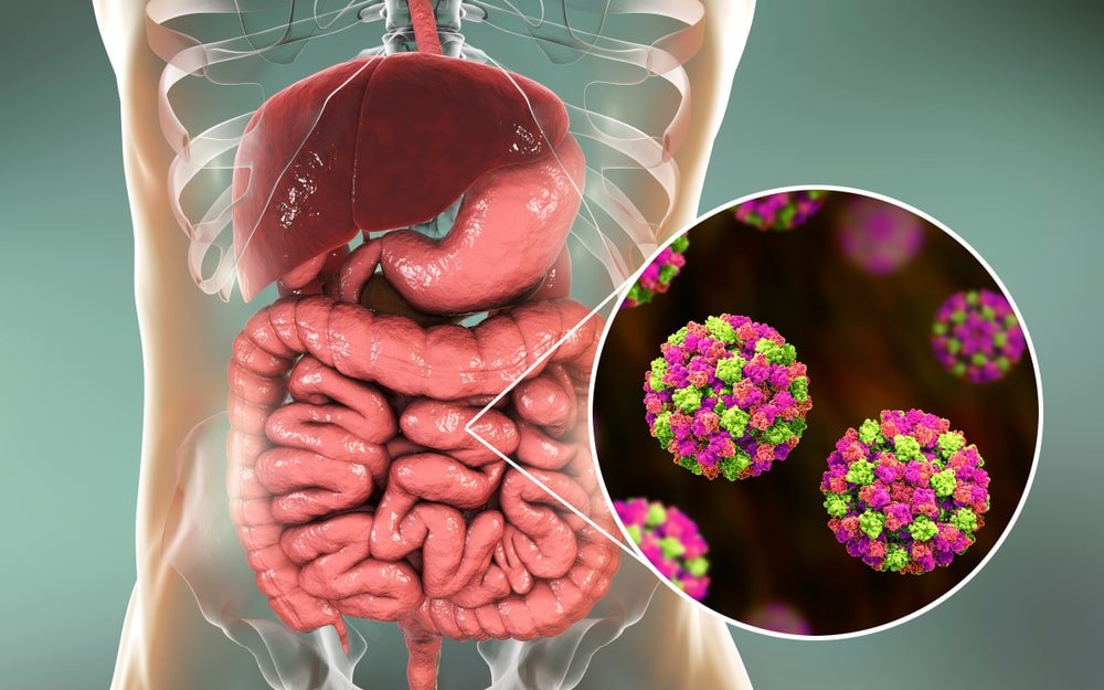 Common stomach problems
